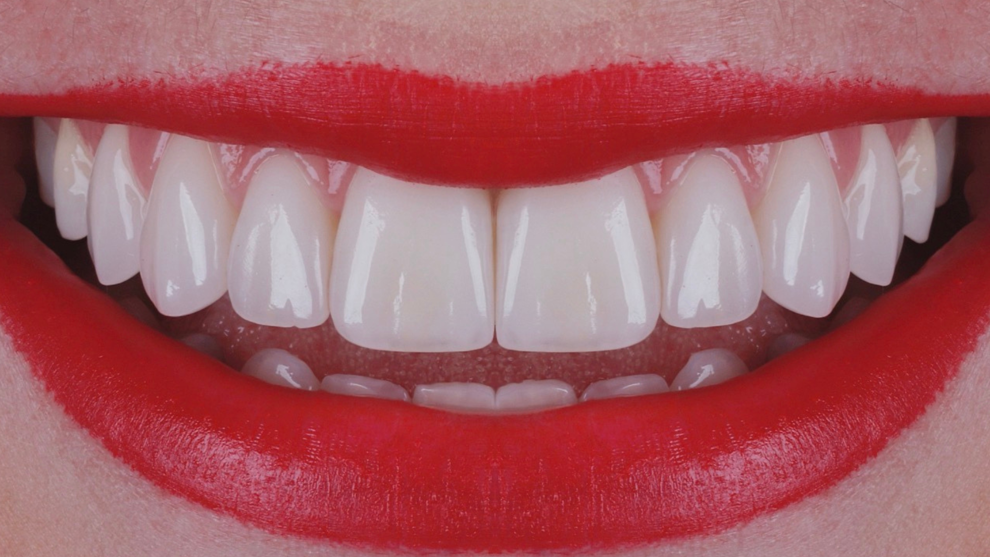 Reabilitação Oral Estética Biomimética com Planeamento Clínico Avançado